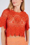 01581 Top